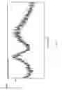 Fig. 08 - Crystalline form of (S)-N-(5-((R)-2-(2,5-difluorophenyl)-pyrrolidin-1-yl)-pyrazolo[1,5-A]pyrimidin-3-yl)-3-hydroxypyrrolidine-1-carboxamide hydrogen sulfate