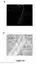 Fig. 15 - Crystalline form of (S)-N-(5-((R)-2-(2,5-difluorophenyl)-pyrrolidin-1-yl)-pyrazolo[1,5-A]pyrimidin-3-yl)-3-hydroxypyrrolidine-1-carboxamide hydrogen sulfate