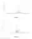 Fig. 28 - Crystalline form of (S)-N-(5-((R)-2-(2,5-difluorophenyl)-pyrrolidin-1-yl)-pyrazolo[1,5-A]pyrimidin-3-yl)-3-hydroxypyrrolidine-1-carboxamide hydrogen sulfate