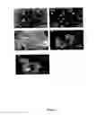 Fig. 02 - SUSTAINED RELEASE DRUG DELIVERY SYSTEM