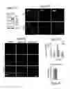 Fig. 08 - METHODS OF PREVENTING TUMOR METASTASIS, TREATING AND PROGNOSING CANCER AND IDENTIFYING AGENTS WHICH ARE PUTATIVE METASTASIS INHIBITORS