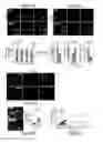 Fig. 11 - METHODS OF PREVENTING TUMOR METASTASIS, TREATING AND PROGNOSING CANCER AND IDENTIFYING AGENTS WHICH ARE PUTATIVE METASTASIS INHIBITORS