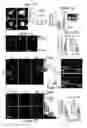 Fig. 12 - METHODS OF PREVENTING TUMOR METASTASIS, TREATING AND PROGNOSING CANCER AND IDENTIFYING AGENTS WHICH ARE PUTATIVE METASTASIS INHIBITORS