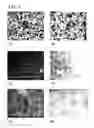 Fig. 06 - CROSSLINKED CATION EXCHANGE POLYMERS, COMPOSITIONS AND USE IN TREATING HYPERKALEMIA