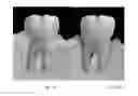 Fig. 02 - COMPOSITIONS AND METHODS RELATING TO TREATMENTS OF THE ORAL CAVITY