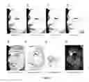 Fig. 10 - Topical formulation for skin care