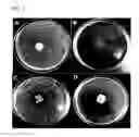 Fig. 03 - Composition comprising antifungal agents for treating vulvovaginitis and vaginosis