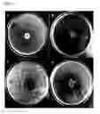 Fig. 04 - Composition comprising antifungal agents for treating vulvovaginitis and vaginosis