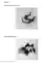 Fig. 02 - Seaweed extract and composition useful against cancer cells