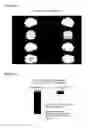 Fig. 08 - AGENT CONTAINING IMIDAZOLE DIPEPTIDE