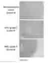 Fig. 46 - Method and compositions comprising a CT20 peptide