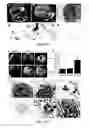 Fig. 11 - PEPTIDE AND SMALL MOLECULE AGONISTS OF EPHA AND THEIR USES IN DISEASE