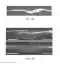 Fig. 03 - Pharmaceutical compositions for treating or preventing bone conditions