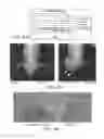 Fig. 08 - Pharmaceutical compositions for treating or preventing bone conditions