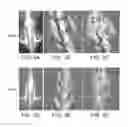 Fig. 09 - Pharmaceutical compositions for treating or preventing bone conditions
