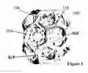 Fig. 04 - CLATHRIN REPLACEMENT THERAPEUTICS