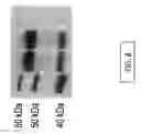 Fig. 10 - Replication defective adenovirus vector in vaccination