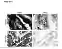 Fig. 32 - Methods for treating cancer by administering humanized pan-HER antibody compositions