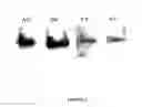Fig. 04 - Variable domains of camelid heavy-chain antibodies directed against glial fibrillary acidic proteins
