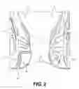 Fig. 03 - Methods and systems for stiffening of tissue for improved processing