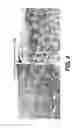 Fig. 05 - Methods and systems for stiffening of tissue for improved processing