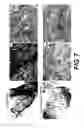 Fig. 08 - Methods and systems for stiffening of tissue for improved processing