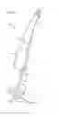 Fig. 03 - Ventricular assist device for intraventricular placement