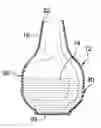Fig. 01 - Vaginal Hygiene Assembly