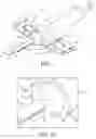 Fig. 02 - Safety needle assemblies and related methods
