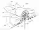 Fig. 01 - Needle shielding assemblies and infusion devices for use therewith