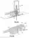 Fig. 35 - Needle shielding assemblies and infusion devices for use therewith