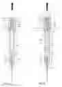 Fig. 04 - Selectable needle syringe with retraction plunger