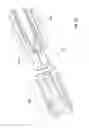 Fig. 35 - Medicament delivery device