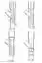 Fig. 04 - Gas removal systems and methods