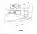 Fig. 25 - Integrated, extendable anesthesia system
