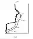 Fig. 08 - Personalized forced air purifier