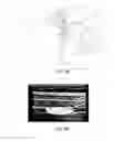 Fig. 05 - Continuous Transversus Abdominis Plane Block