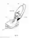 Fig. 08 - Insertion device with protection against reuse