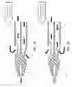Fig. 07 - Catheter assembly including a multi-lumen configuration