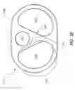 Fig. 40 - Catheter assembly including a multi-lumen configuration