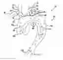 Fig. 01 - Carotid artery occluding apparatus with first and second occluding balloons