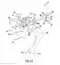 Fig. 12 - Carotid artery occluding apparatus with first and second occluding balloons