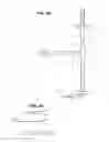 Fig. 04 - Biliary diversion catheter