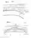 Fig. 05 - Biliary diversion catheter