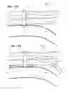 Fig. 15 - Biliary diversion catheter