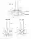 Fig. 22 - Biliary diversion catheter