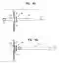 Fig. 06 - SINUS STENT