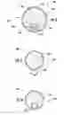 Fig. 03 - Intravesical drug delivery devices and methods including elastic polymer-drug matrix systems