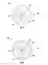 Fig. 04 - Intravesical drug delivery devices and methods including elastic polymer-drug matrix systems
