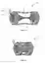 Fig. 04 - Constriction valve